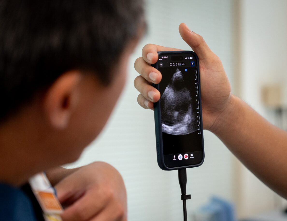 En la mano se sostiene un teléfono inteligente con un cable conectado y la persona mira desenfocada el teléfono de la izquierda. El teléfono muestra cómo se ve la ecografía.